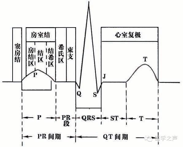 正常心电图1
